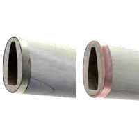 Koiguchi Reinforcement - Image 4